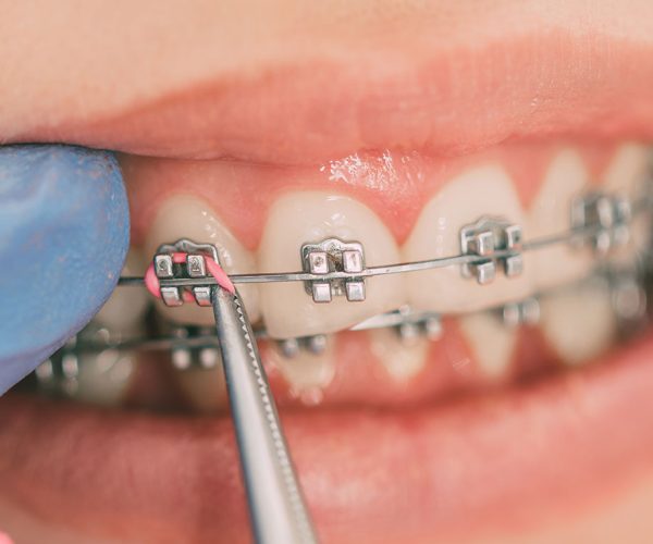 dentista-viterbo-lattanzi-studio-odontoiatrico